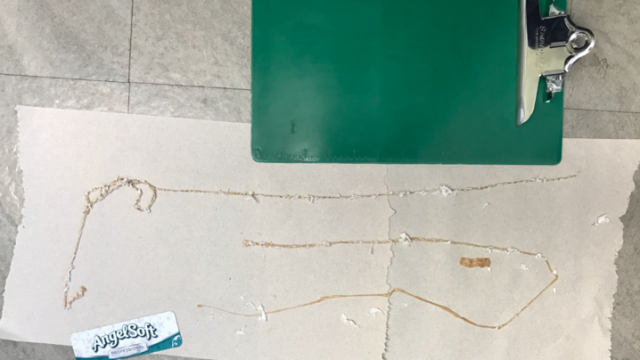 Cacing pita di perut pria AS (Foto: Dok. DR Kenny Bahn)