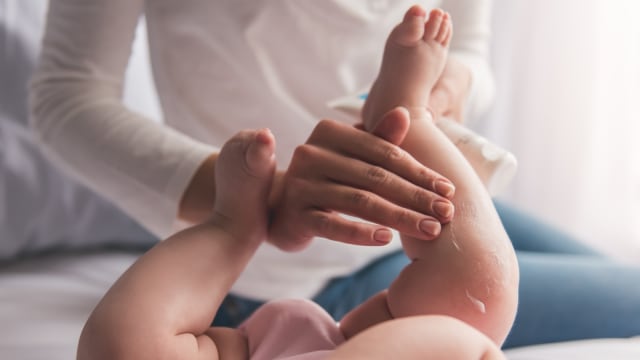 Ilustrasi lotion bayi (Foto: Thinstock)