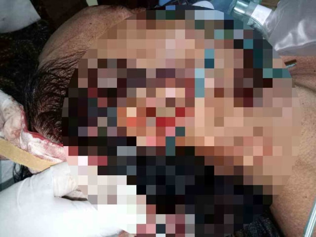 Korban Penganiayaan di Bilaporah Bangkalan Tewas