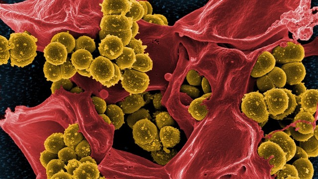 Ilustrasi bakteri. (Foto: skeeze via Pixabay)