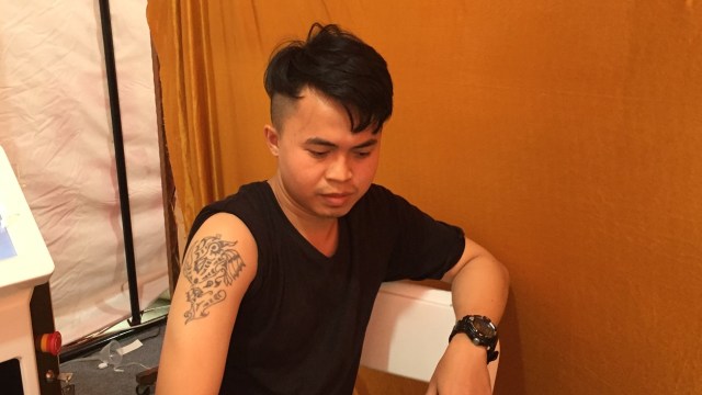 Asep saat menghapus tatonya (Foto:  Moh Fajri/kumparan)