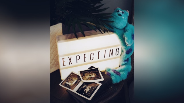 Konsep foto USG anak Putri Titian. (Foto: Instagram/@putrititian)