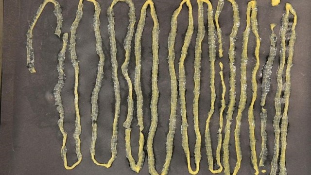 Cacing pita sepanjang 2,8 meter. (Foto: Dok. Singapore General Hospital's Department of Microbiology)