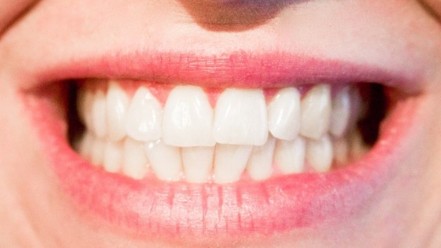 5 Makanan yang Bisa Memutihkan Gigi (Foto: Pixabay)