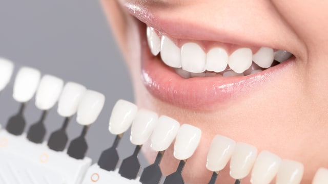 Gigi putih. (Foto: Thinkstock)