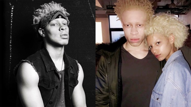 Leo Jonah Model Albino (Foto: dok. Instagram @leo_jonah)