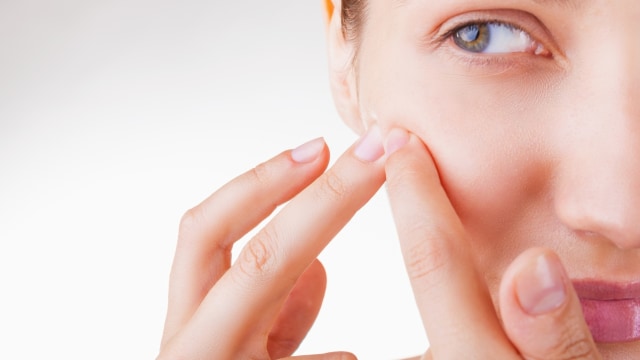 Minuman penghilang jerawat. Foto: Pixabay