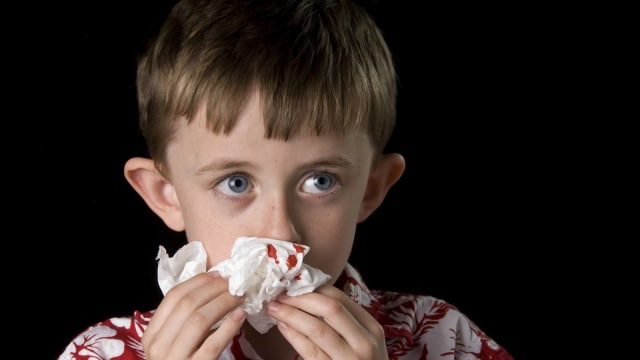 Ilustrasi anak mimisan. (Foto: Thinkstock)