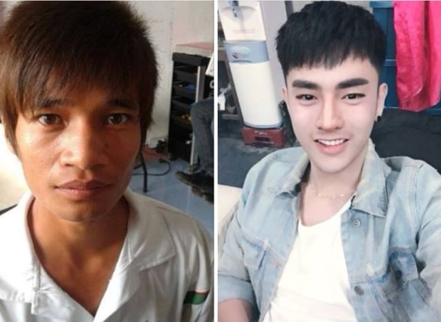 Lakukan 30 Operasi Inilah Perubahan Seorang Pria Korea