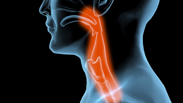 Mengobati peradangan (Foto: Thinkstock)