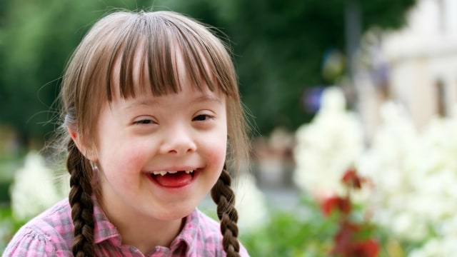 Ilustrasi anak down syndrome. Foto: Thinkstock