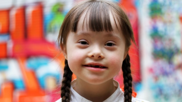 Ilustrasi anak down syndrome. Foto: Thinkstock