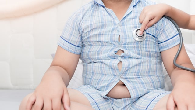 Obesitas pada anak (Foto: Thinkstock)