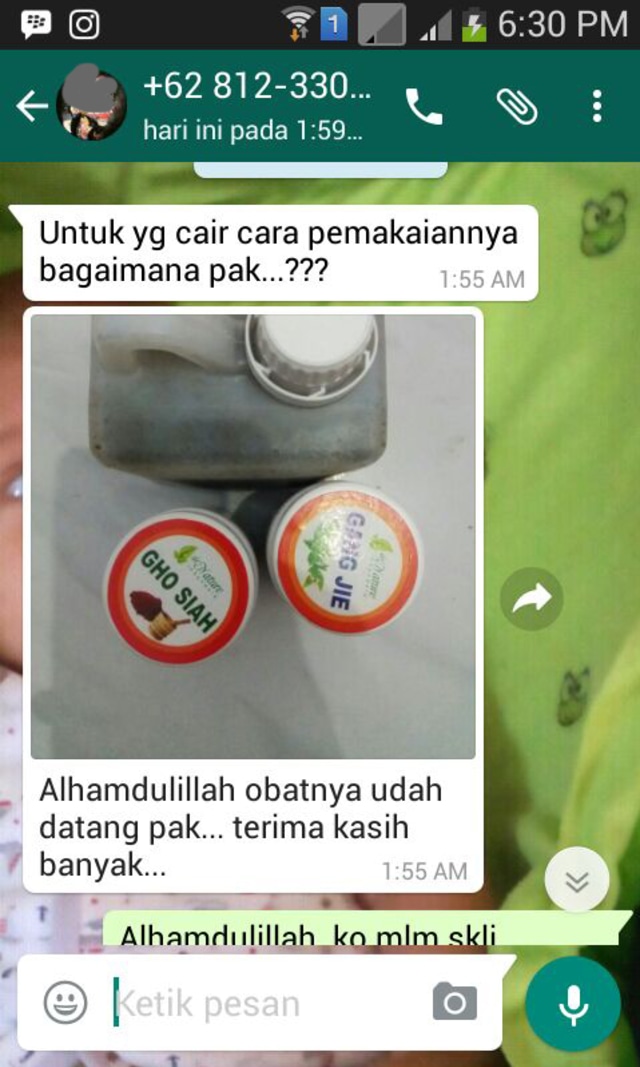 Obat Setalah Kencing Terasa Sakit Di Apotik Menurut Resep Dokter (1)