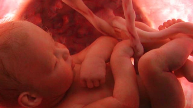 Apa Yang Terjadi Di Usia Janin 7 Bulan? (1)