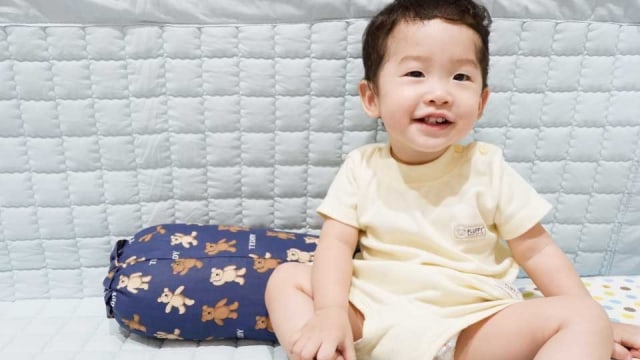 Cara Mengatasi Gigi Anak agar Tidak Kuning