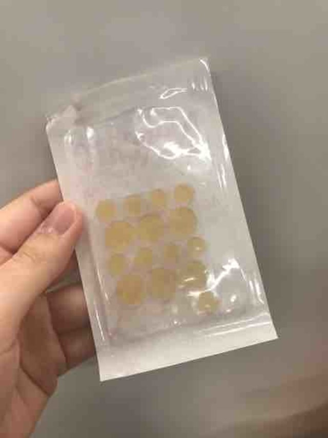 Gunakan Nextcare Acne Cover,Jerawat Kempes Seketika (1)