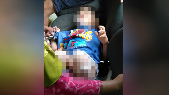 Korban Kapal Dishub yang meledak. (Foto: Dok. Damkar Jakarta Utara)