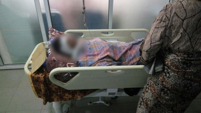 Korban Kebakaran sumur minyak Aceh Timur (Foto: Dok. Istimewa)