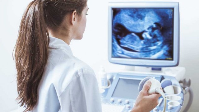 Mengenal Trisomi 13, 18 Dan 21 Pada Bayi