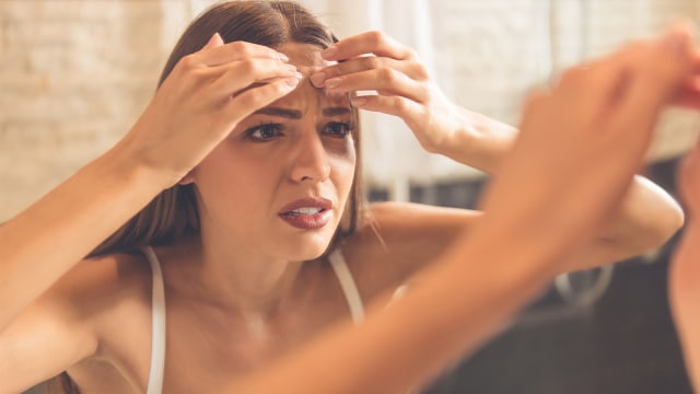 Ilustrasi Jerawat (Foto: Thinkstock)