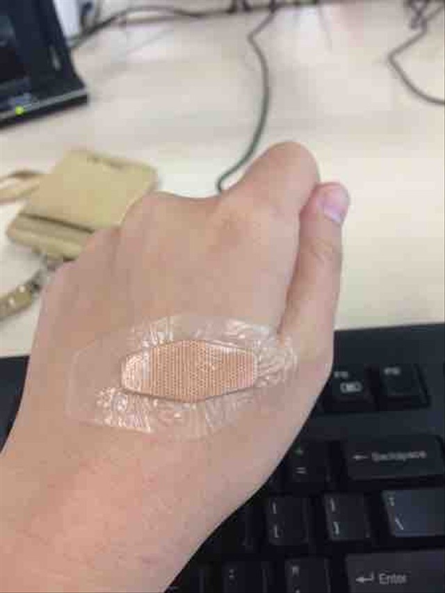 Tetap Percaya diri walaupun ada luka dengan Nexcare Bandages (5)