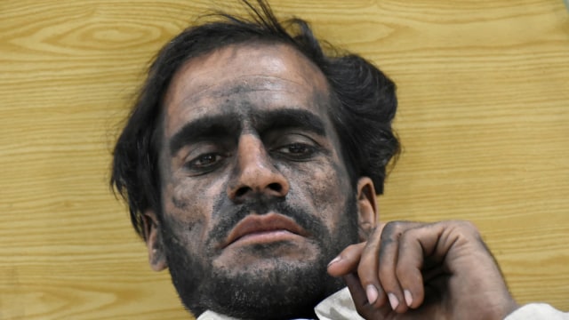 Korrban ledakan tambang batubara di Pakistan. (Foto: REUTERS/Naseer Ahmed)