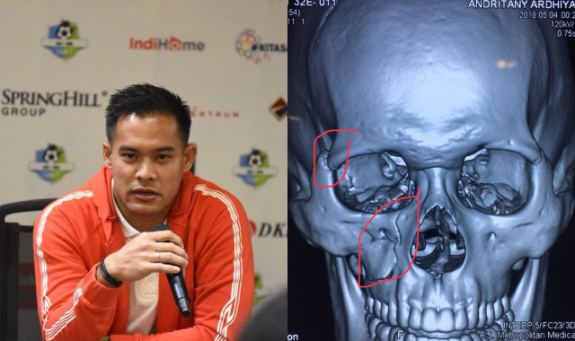 Kiper Persija, Andritany Ardhiyasa. (Foto: dok. Media Persija dan Gede Widiade)