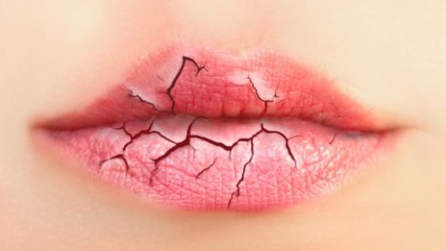 Tips Mengatasi Bibir Kering Selama Puasa