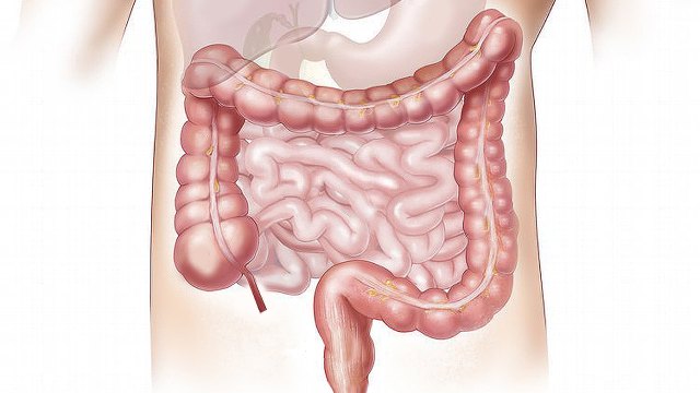 Usus besar dan saluran pencernaan manusia. (Foto: Elionas2 via pixabay)