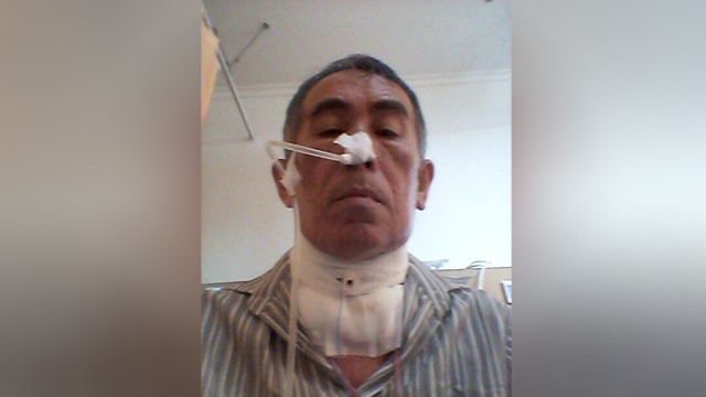 Zainal, Perokok aktif yang terkena Kanker Laring (Foto: Dok. Zainul Abidin)