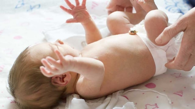 Hernia pada Bayi