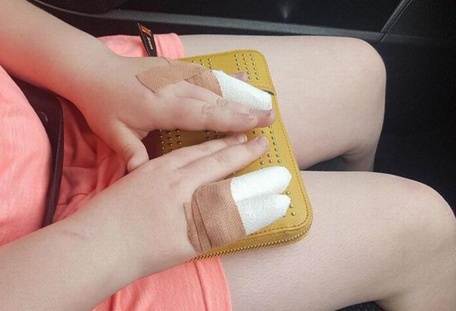 Squishy Membuat Gadis Kecil Ini Melepuh (1)