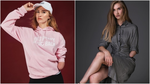 Kelly Knox, salah satu model disabilitas (Foto: dok. Instagram/@kellyknox)