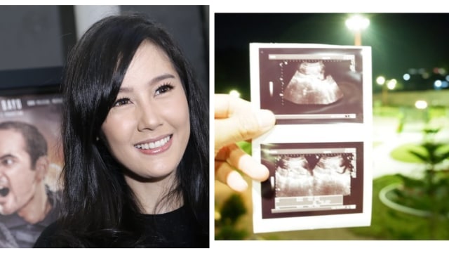 Ardina Rasti Umumkan Kehamilan Anak Pertama (Foto: Adinda Githa Murti Sari Dewi/kumparan, IG @arie10andika)
