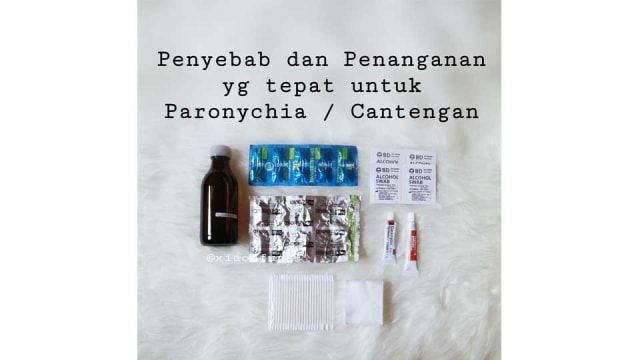 Penyebab dan Penanganan Cantengan pada Ibu dan Anak (1)