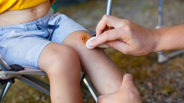 Cedera lutut pada anak (Foto: shutterstock)