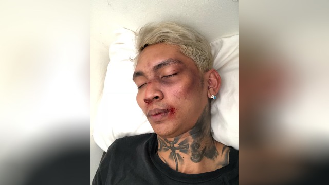 Young Lex menjadi korban pemukulan, Kamis (9/8). (Foto: Instagram @young_lex18)