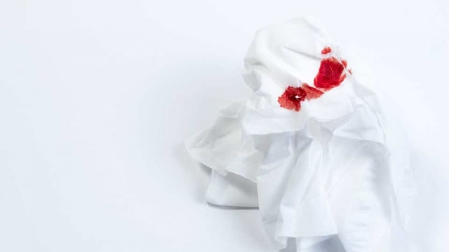 Penyebab Epistaksis / Mimisan