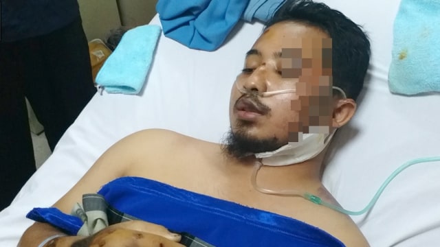 Penghafal 30 juz Quran, Ustaz Syukri mengalami kecelakaan, Selasa (14/8). (Foto: Dok. Info Dakwah Center)