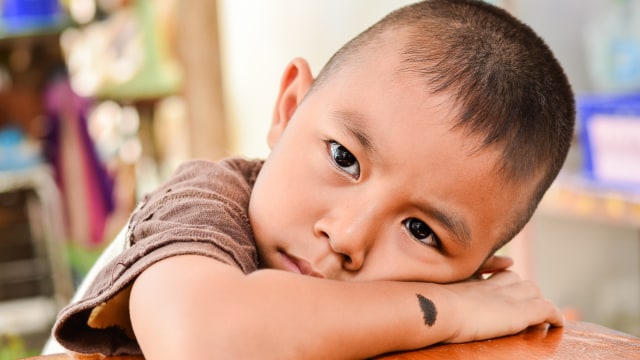 Tanda Tahi Lalat Anak Berbahaya. Foto: Shutterstock
