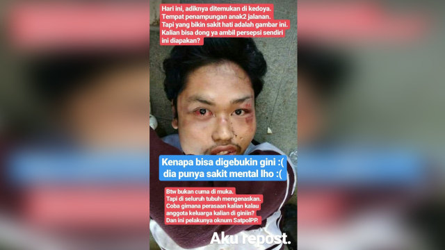 Anak gangguan jiwa disiksa sedang dirawat di penampungan anak jalanan di Kedoya, Jakarta Barat. (Foto: Dok. Istimewa)
