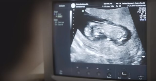 Screenshot USG Kehamilan Raisa. (Foto: YouTube: Raisa6690)