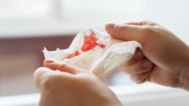 Cara Mengatasi Mimisan (Epistaksis) pada Anak