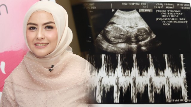 Hamil anak kedua, Revalina S. Temat unggah foto hasil USG. (Foto: Munady Widjaja, Instagram @vatemat)