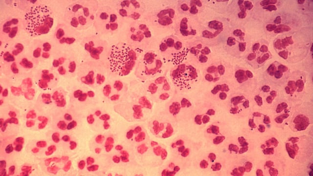 Neisseria gonorrhoeae penyebab gonore. (Foto: Centers for Disease Control and Prevention)