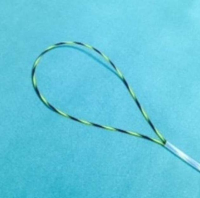 Alat khusus untuk mengeluarkan dildo dari lubang anus (Foto: Tringali, A. et al./BMJ Case Reports, 2018)