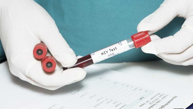 Tes yang Digunakan untuk Mendiagnosis HIV
