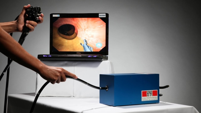 Ilustrasi kolonoskopi (Foto: CSIRO via Wikimedia Commons)