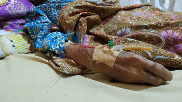 Kusmi, pasien tumor payudara peserta BPJS Kesehatan (Foto: Fauzan Dwi Anangga/kumparan)